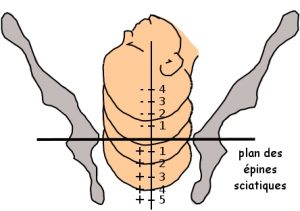 fig11