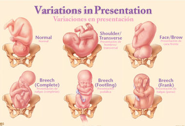 foetus presentation